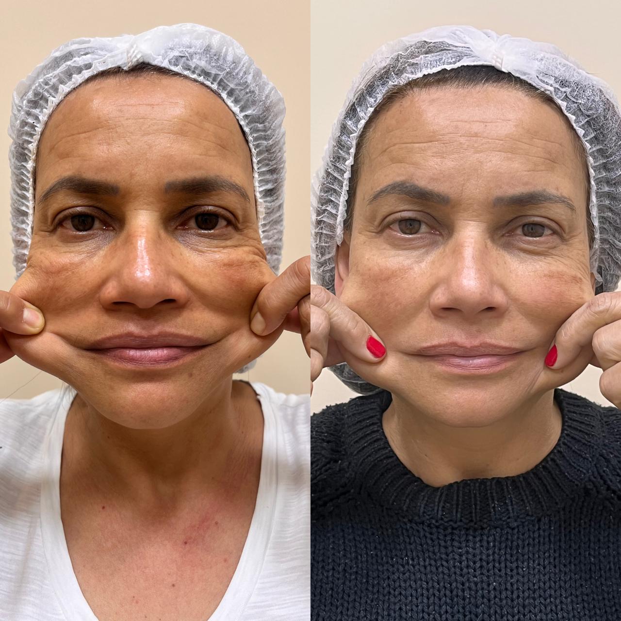Antes e depois de Caso Clínico 01