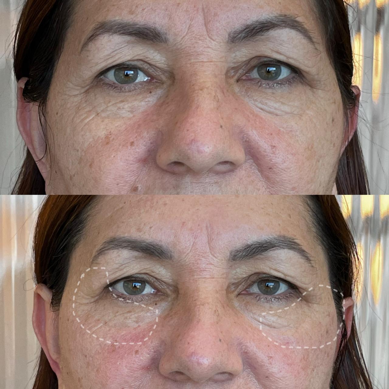 Antes e depois de Caso Clínico 02