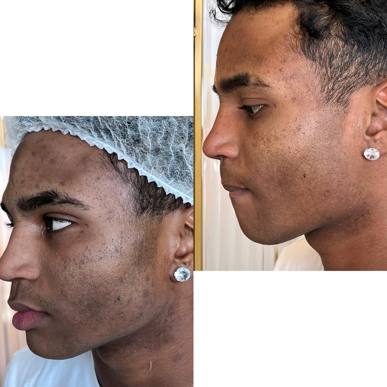 Antes e depois de Caso Clínico
