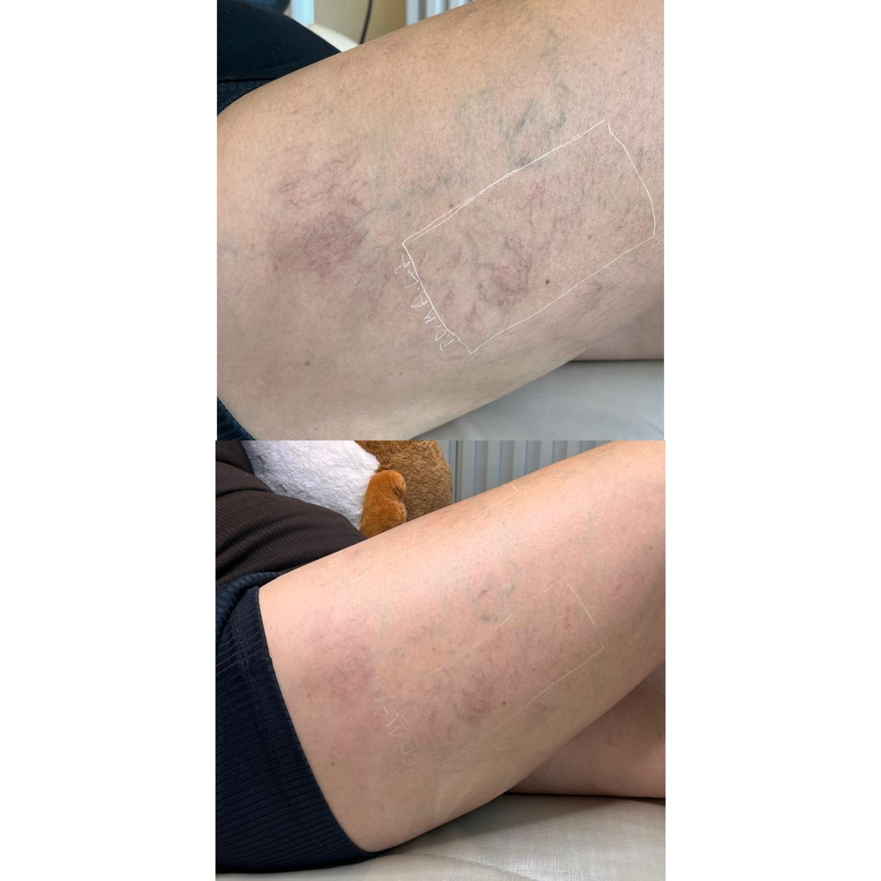 Antes e depois de Caso Clínico 01